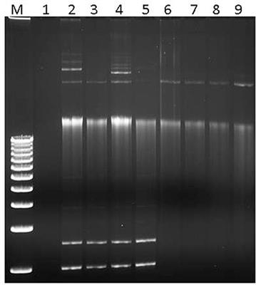 Plasmid-Mediated <mark class="highlighted">Quinolone Resistance</mark> in Shigella flexneri Isolated From Macaques
